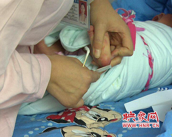 醫(yī)護(hù)人員在為一名新出生嬰兒采足跟血，做疾病篩查