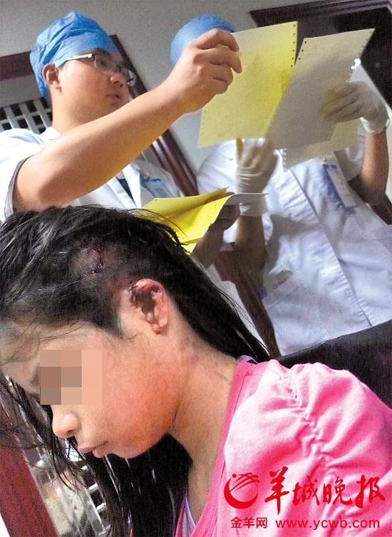 受傷的11歲女孩頭發(fā)被卷入扶梯，耳朵被嚴(yán)重拉傷，需手術(shù)。
