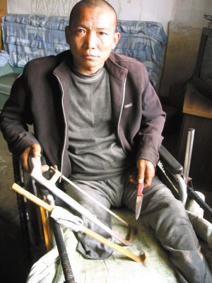 鄭艷良就是用這幾樣簡陋工具，給自己做了右腿截肢手術(shù)。