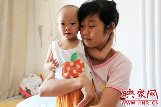 孩子和媽媽在一起，她的右眼已經失明。