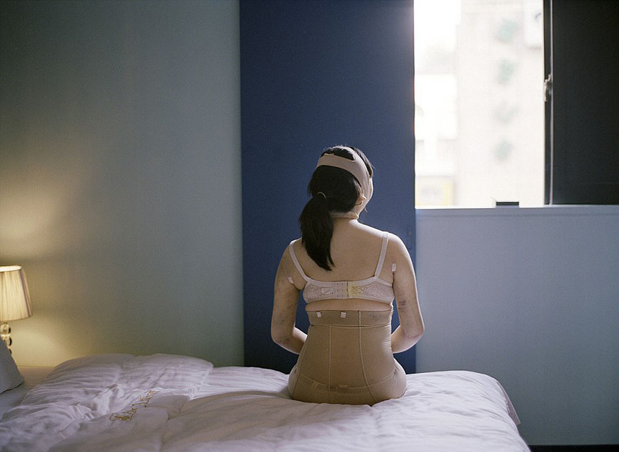 韓攝影師鏡頭記錄患者整容術(shù)后的生活 韓攝影師鏡頭記錄患者整容術(shù)后的生活