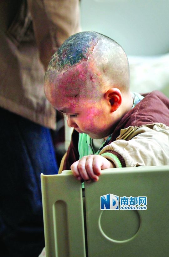 1月8日下午，小寶頭上和臉上都是傷痕。