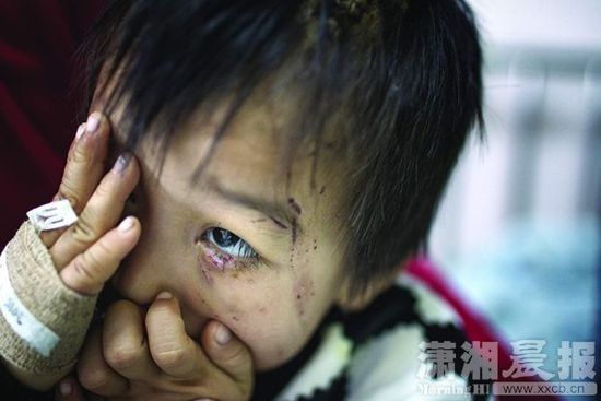 1月13日，湖南省兒童醫(yī)院，4歲的源源用手蒙住了眼睛。