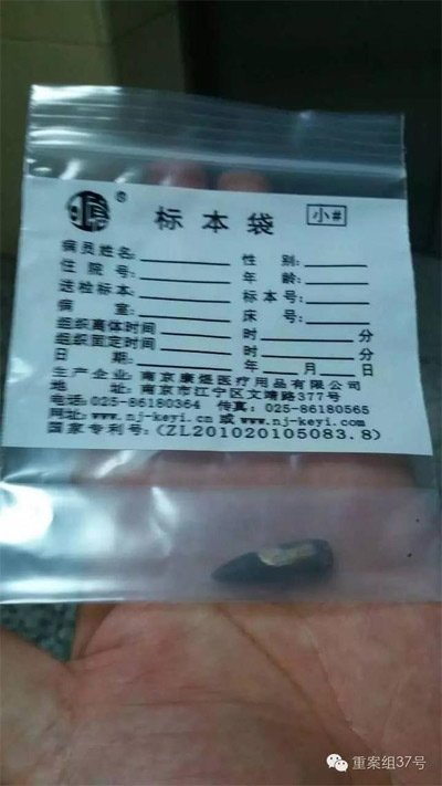 經警方鑒定，秦女士體內取出的子彈系56式步槍射出 。 受訪者供圖