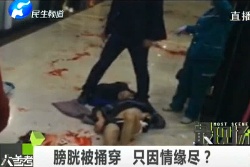 膀胱被捅穿 只因情緣盡？